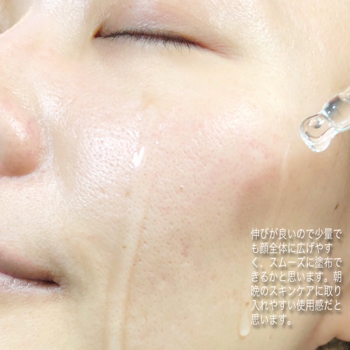 クローザーセラム/Frankly/美容液を使ったクチコミ(3枚目)