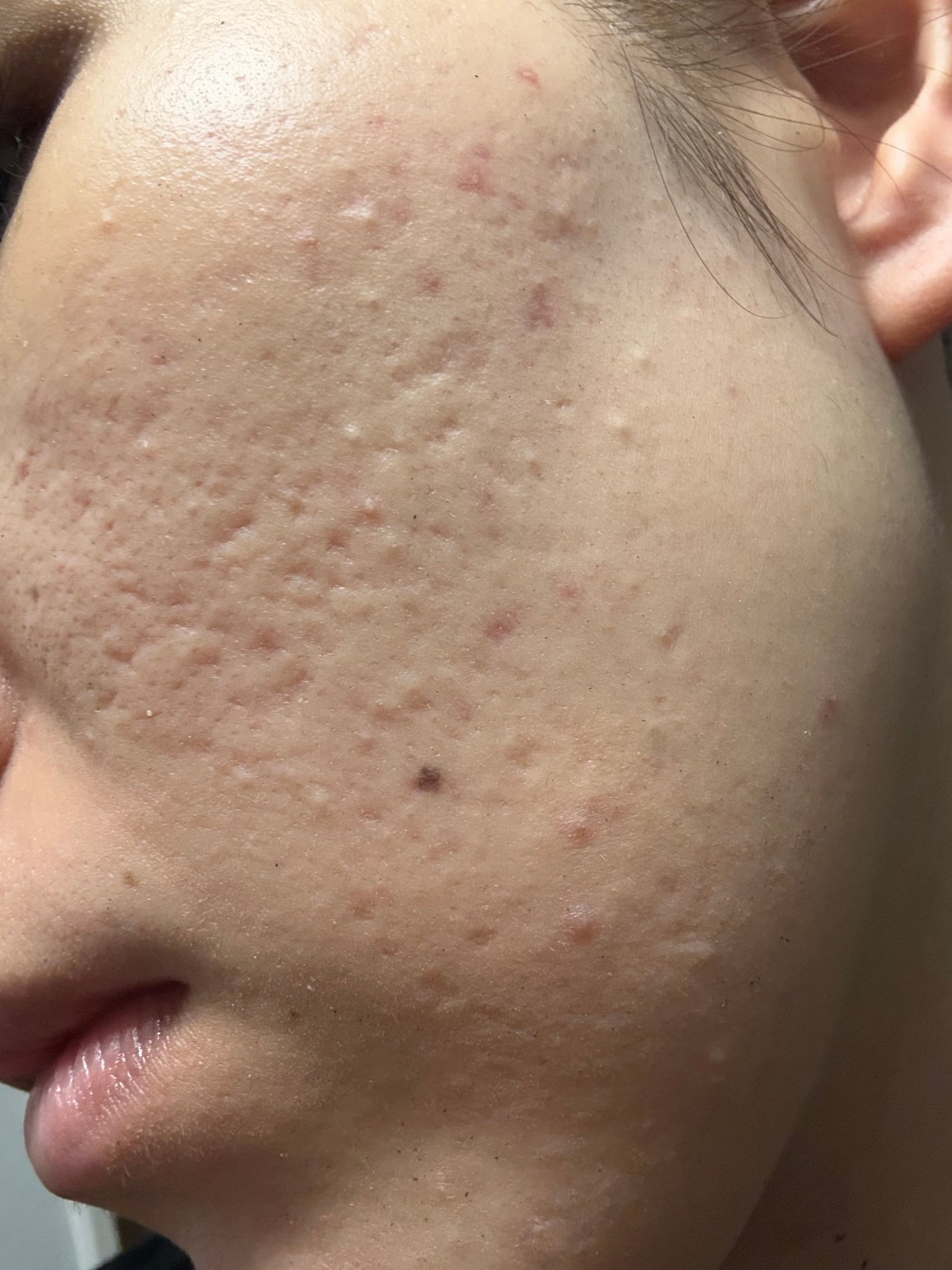 ベースメイク BBクリーム/キュレル/BBクリームを使ったクチコミ(3枚目)