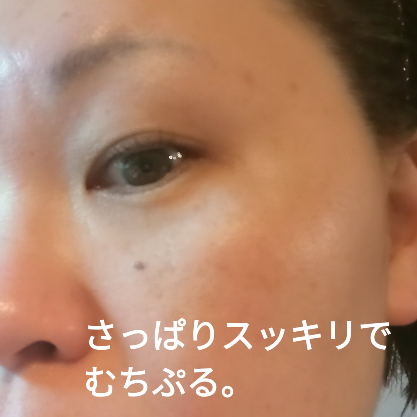 Hydra Forte Ampoule/essenciel/美容液を使ったクチコミ(4枚目)