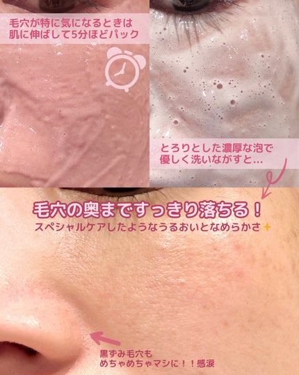 アレンシアフレッシュもちソープ「ロイヤルローズヒップ」/アレンシア/その他洗顔料を使ったクチコミ(5枚目)