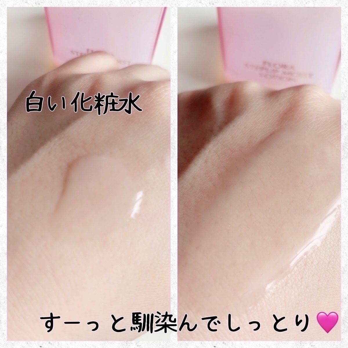  フローラ ステップアップ モイストローション/FTC/化粧水を使ったクチコミ（2枚目）