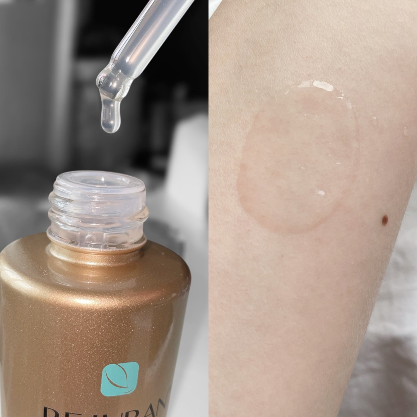 REJURAN ãã¥ã¢ã«ãšãã§ã¯ãã¢ã³ãã« 30ml/REJURAN COSMETICS/çŸå®¹æ¶²ã䜿ã£ãã¯ãã³ãïŒ2æç®ïŒ