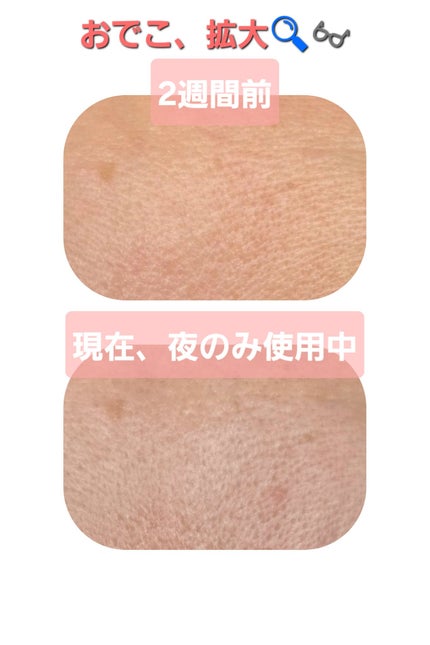 ダーマセプトRX VAセラム/ダーマセプトRX/美容液を使ったクチコミ(4枚目)