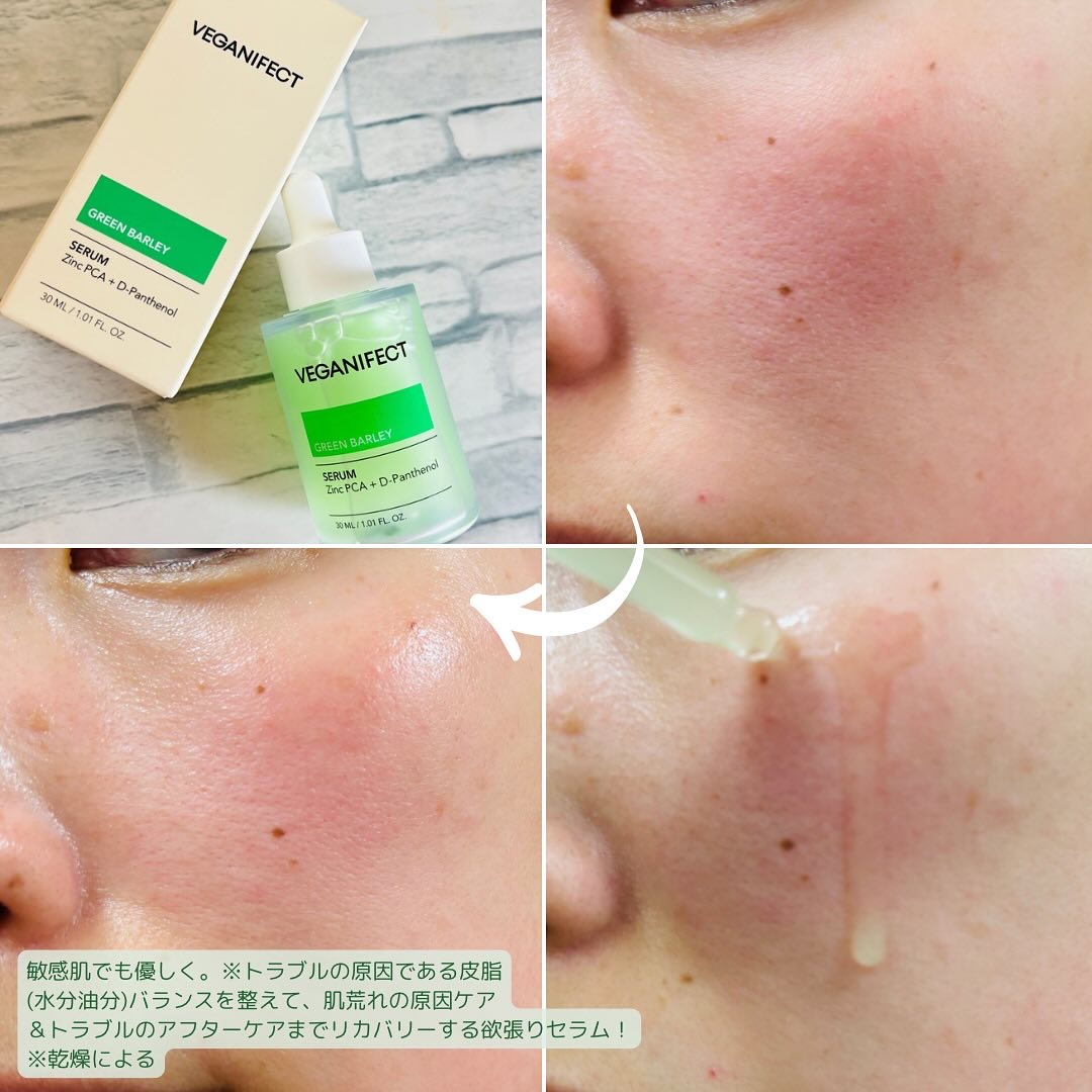 青麦ジンクセラム/Veganifect/美容液を使ったクチコミ（3枚目）
