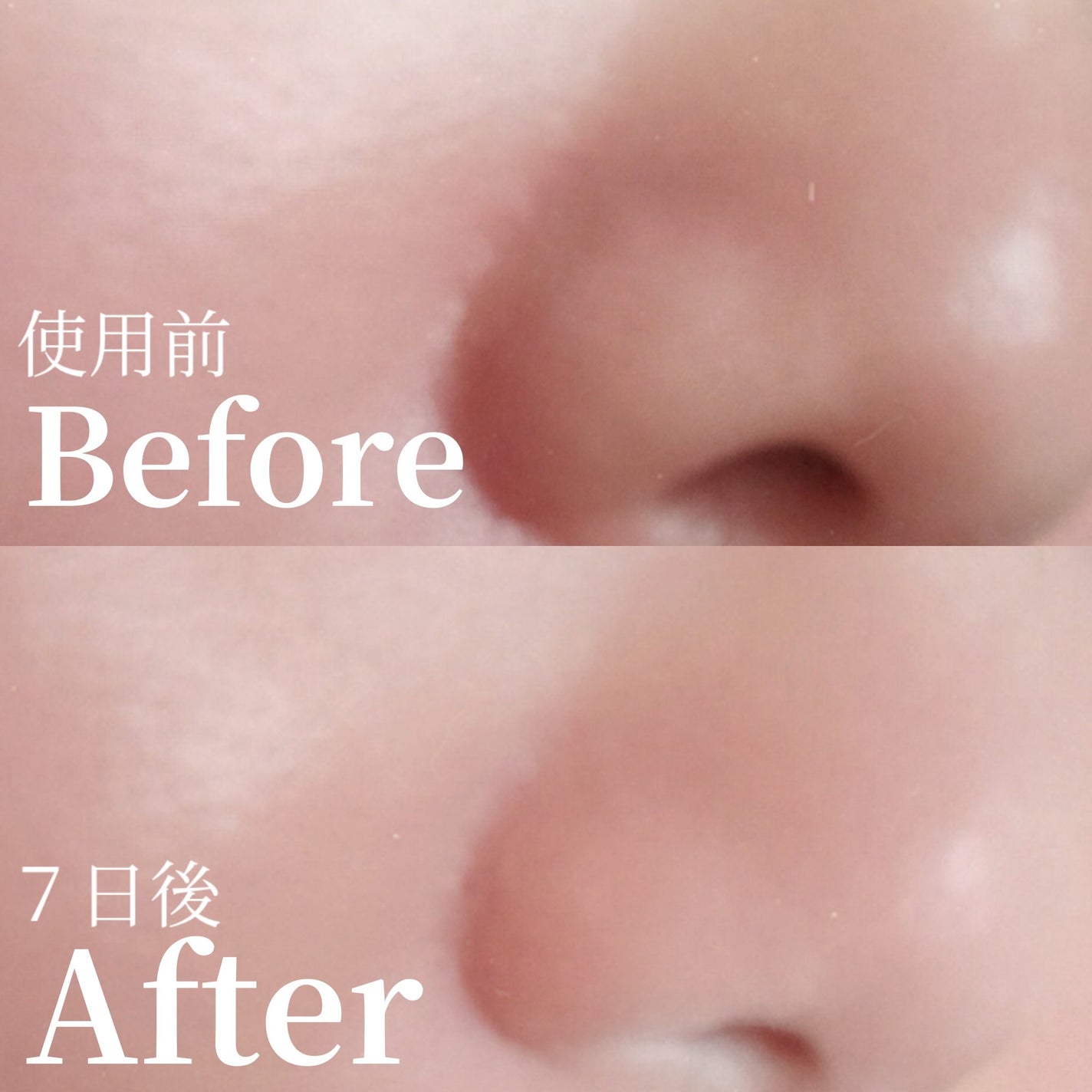 アレンシアフレッシュもちソープ「ロイヤルローズヒップ」/アレンシア/その他洗顔料を使ったクチコミ(8枚目)