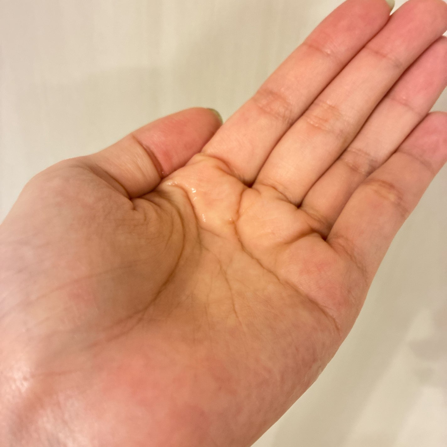 エクソリペア 美容原液ローション クリア/Bアンプル/化粧水を使ったクチコミ(3枚目)