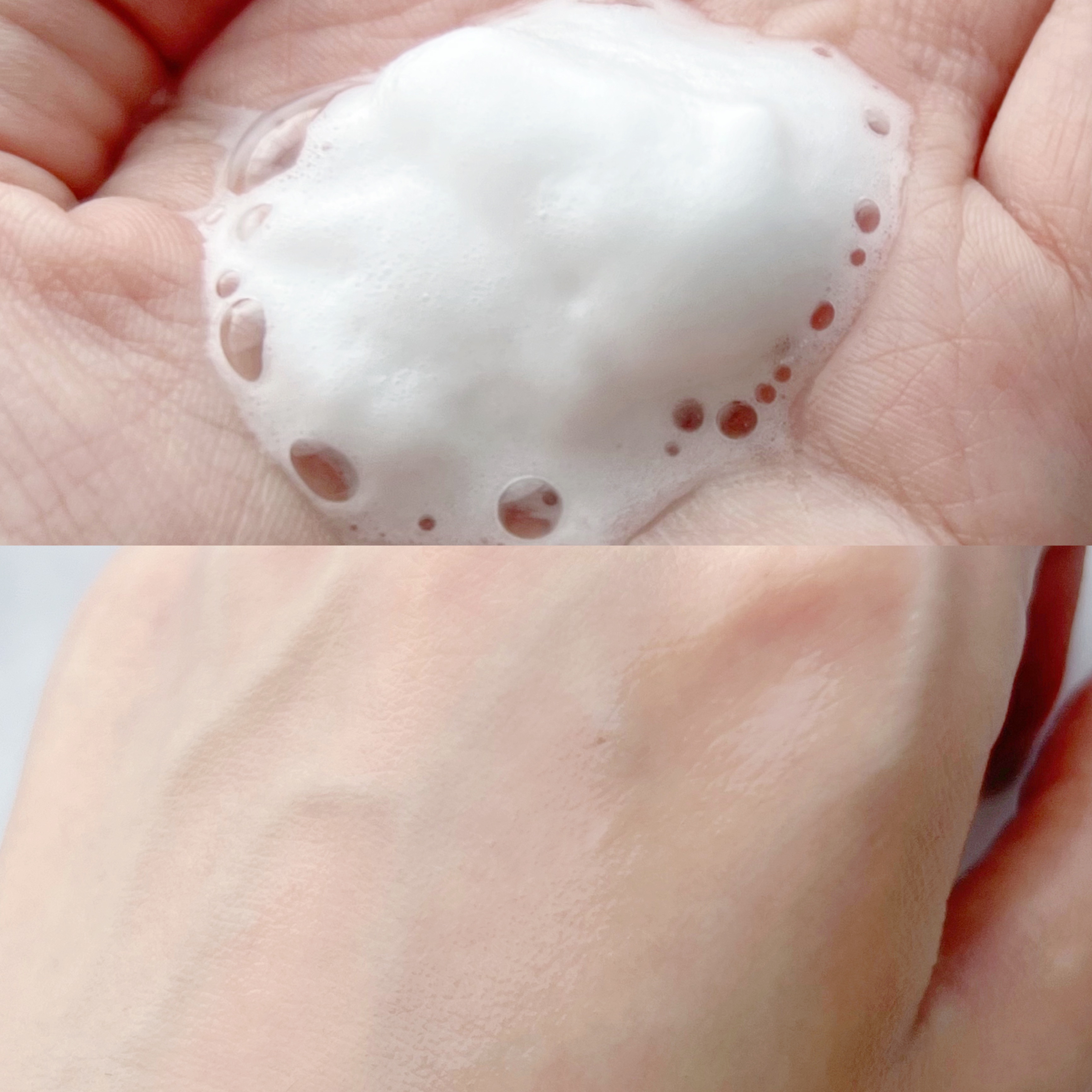 ブルービタミン バブルセラム エッセンス/SKIN SIGNAL/美容液を使ったクチコミ（2枚目）