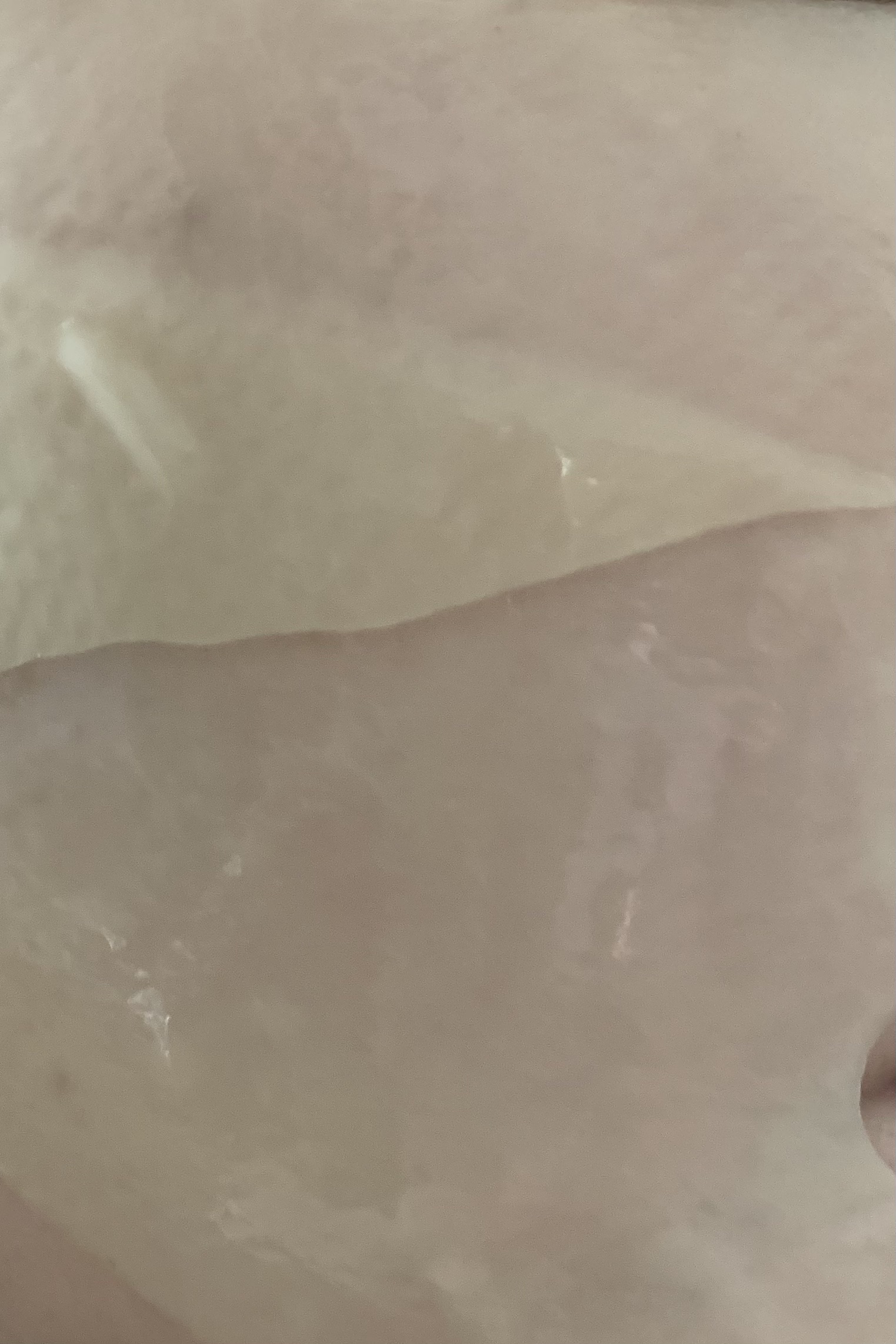 パーフェクト リアル パフォーマンス ビタコラーゲ ンマスクパック /ダーマフィックス/シートマスク・パックを使ったクチコミ（2枚目）