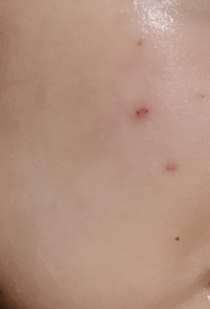 潤浸保湿 乳液/キュレル/乳液を使ったクチコミ（2枚目）