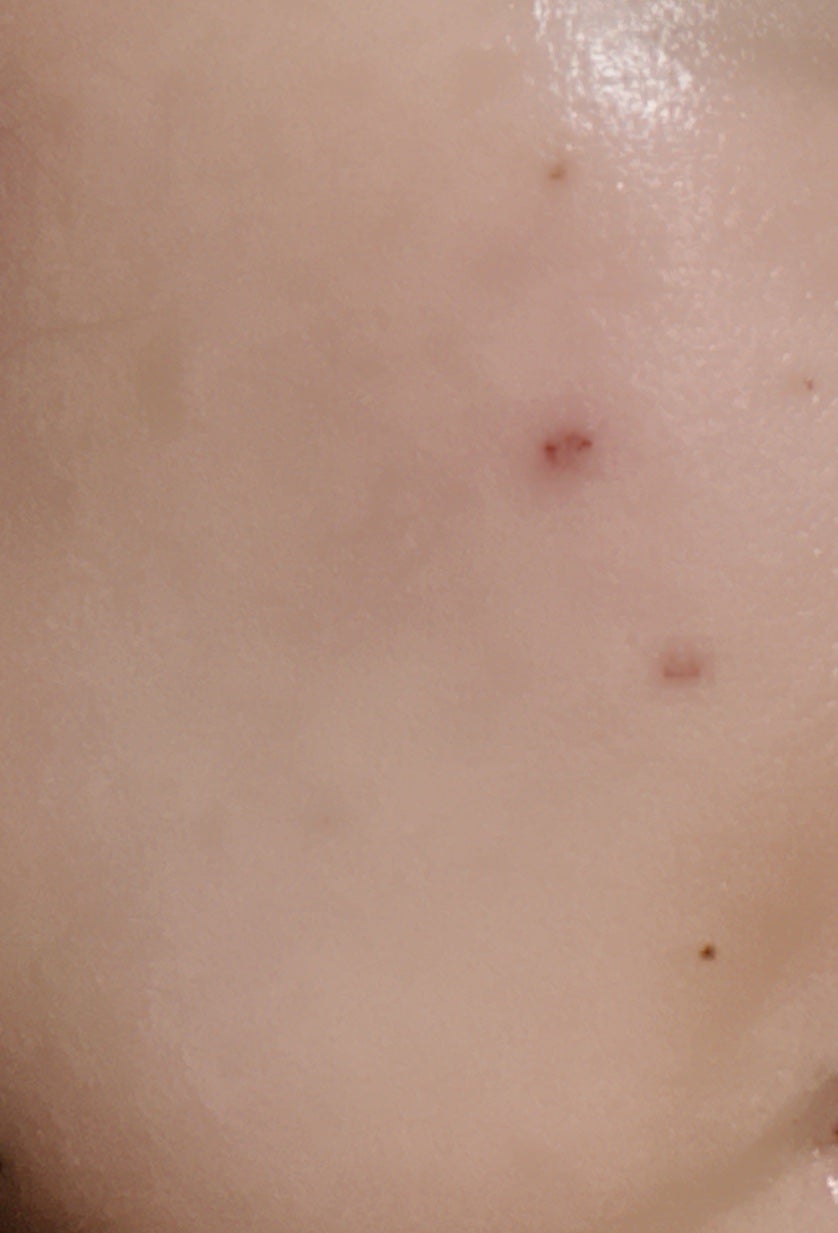 潤浸保湿 化粧水 III とてもしっとり/キュレル/化粧水を使ったクチコミ(2枚目)