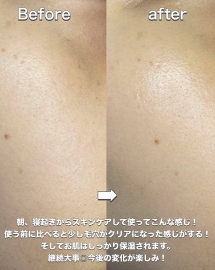 サミュ ガラクトポア セラム/SAM'U/美容液を使ったクチコミ(7枚目)