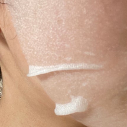 ダーマレーザー スーパーTEATREE100マスク/クオリティファースト/シートマスク・パックを使ったクチコミ(2枚目)