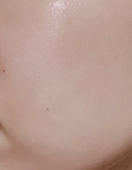 潤浸保湿 化粧水 III とてもしっとり/キュレル/化粧水を使ったクチコミ(4枚目)