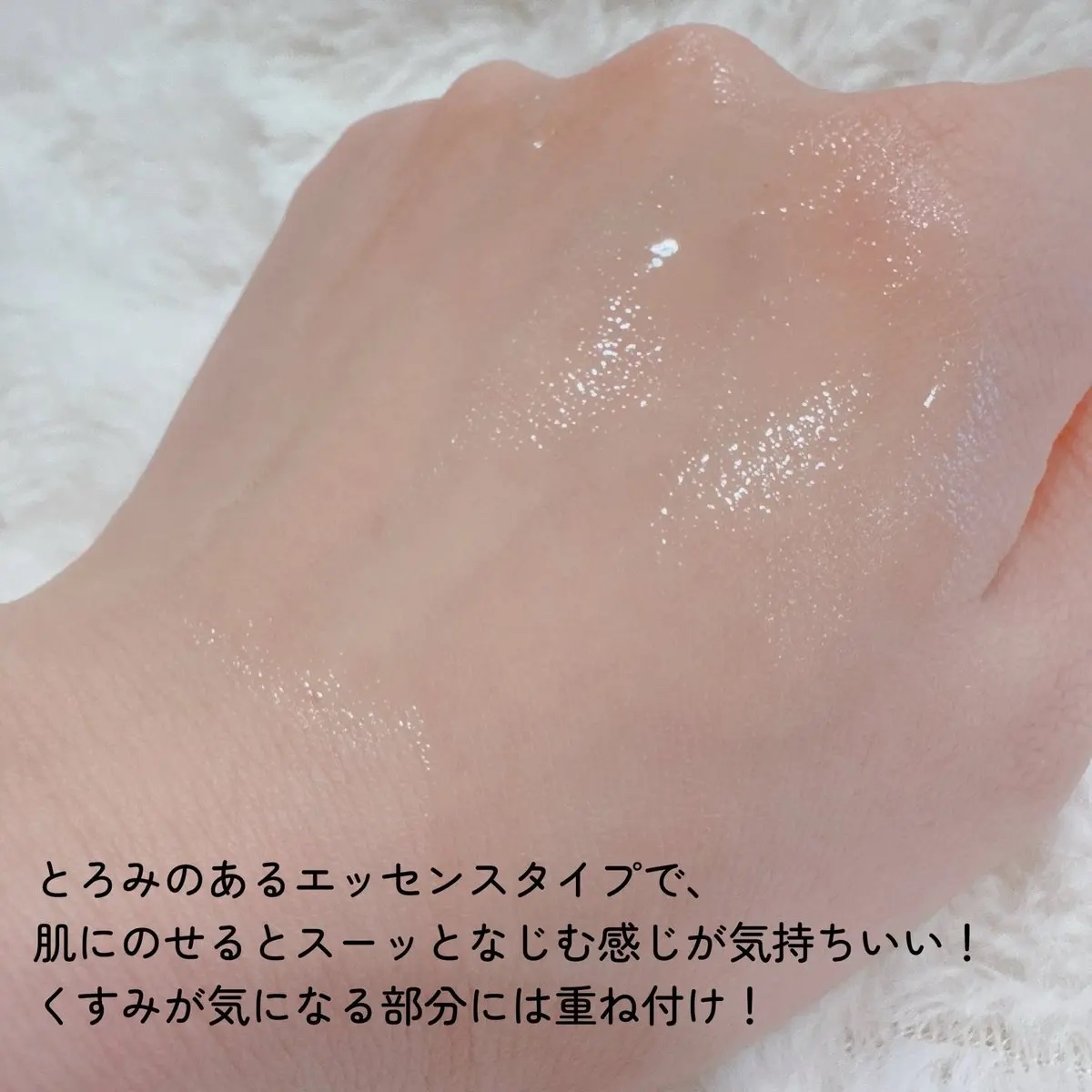 TXナイアシンエッセンストナー/SKIN&LAB/化粧水を使ったクチコミ（3枚目）