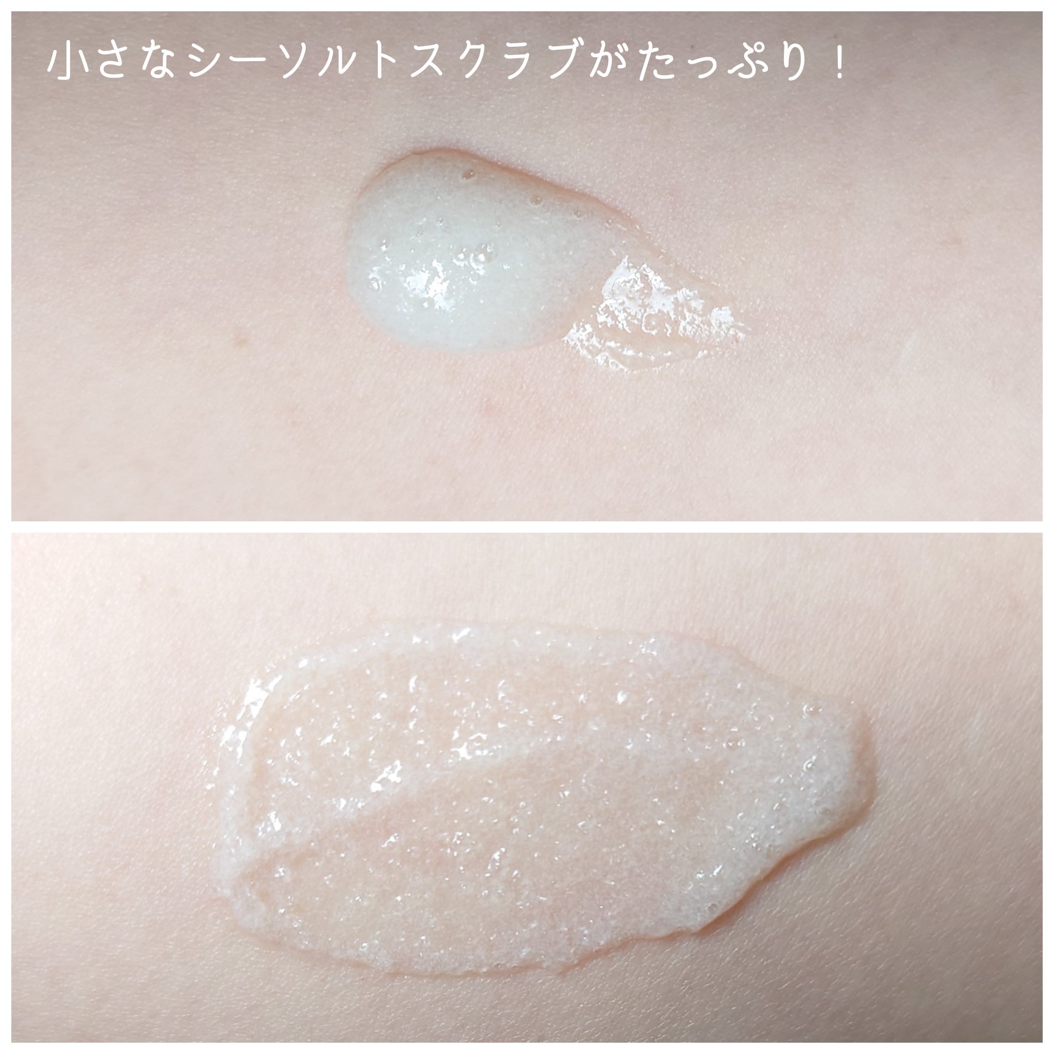 ベタールートクーリングスケーラー/Daleaf/頭皮クレンジングを使ったクチコミ（2枚目）