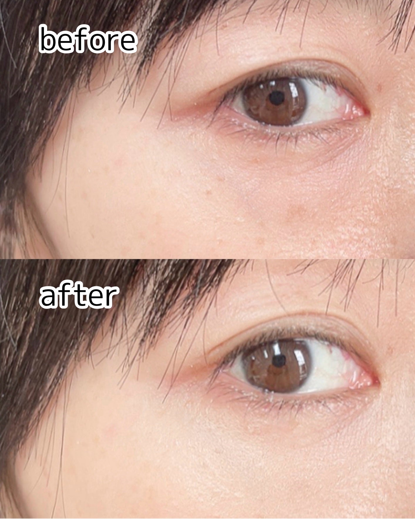 ダーマシンコンシーラー/23years old/リキッドコンシーラーを使ったクチコミ(3枚目)