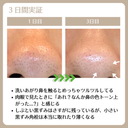 コスメデコルテ AQ 毛穴美容液オイル/DECORTÉ/フェイスオイルを使ったクチコミ(3枚目)