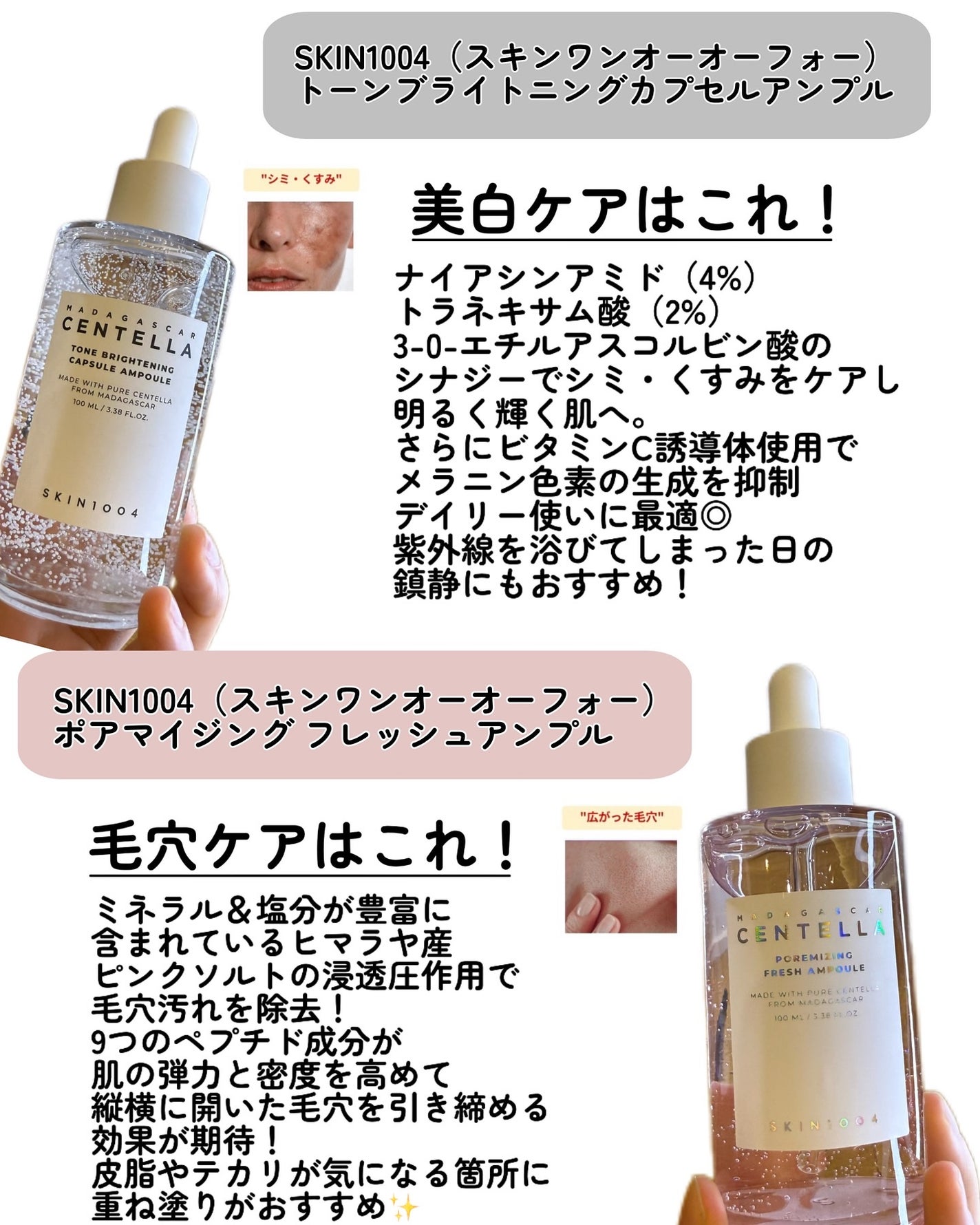 kotori_フォロバ100! on LIPS 「🤍🤍🤍SKIN1004のアンバサダーとして活動中です✊✨今回は..」(3枚目)