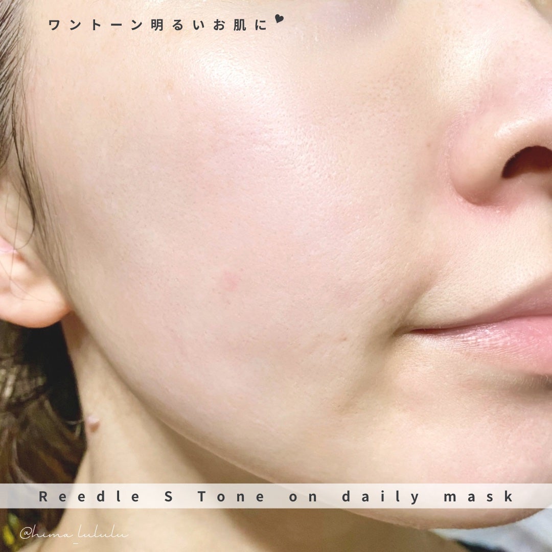 リードルSトーンオンデイリーマスク/VT/シートマスク・パックを使ったクチコミ(3枚目)