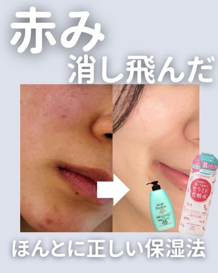 を使ったクチコミ(1枚目)