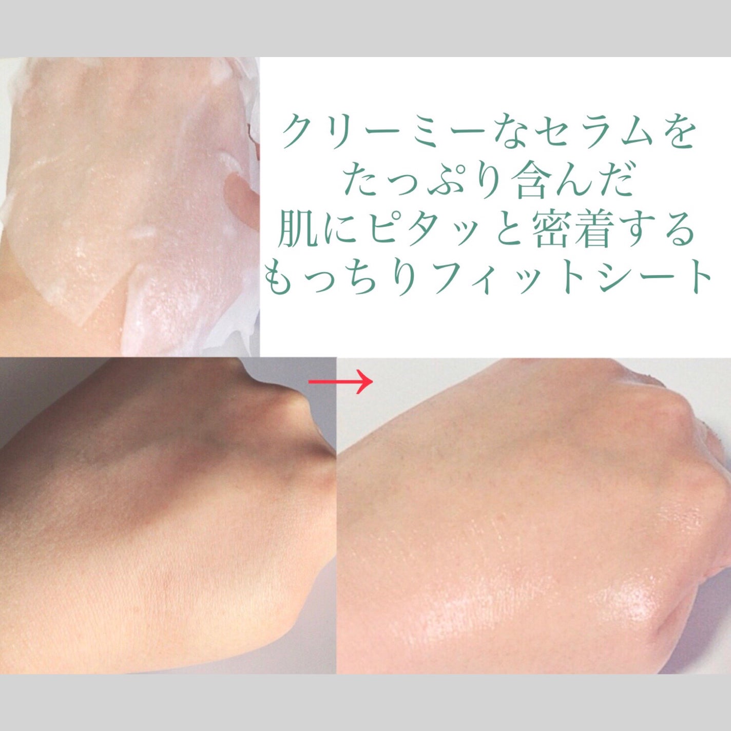 リードルS PDRN+ マスク/VT/シートマスク・パックを使ったクチコミ(3枚目)