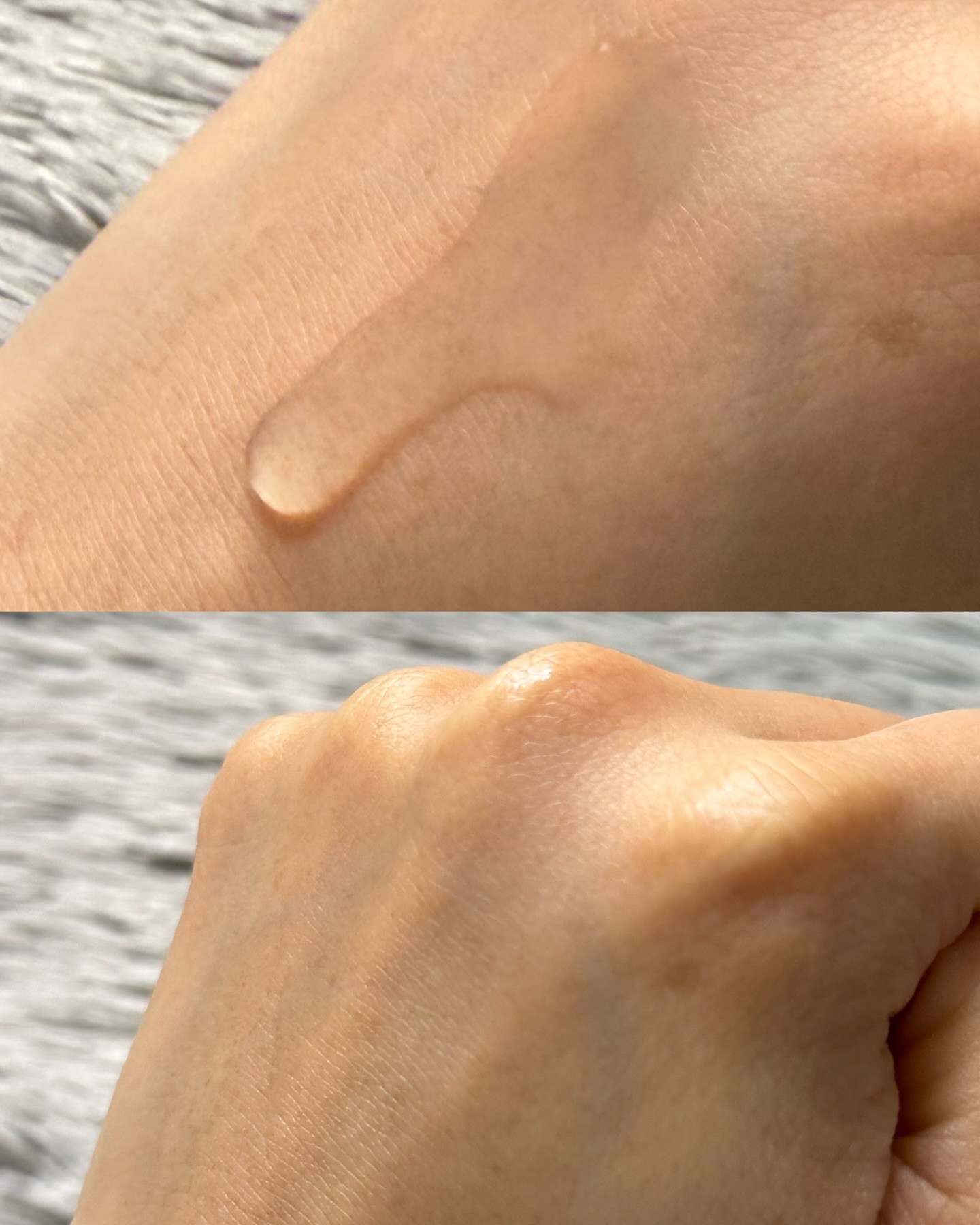 エファクラ ピールケア セラム/ラ ロッシュ ポゼ/美容液を使ったクチコミ（3枚目）