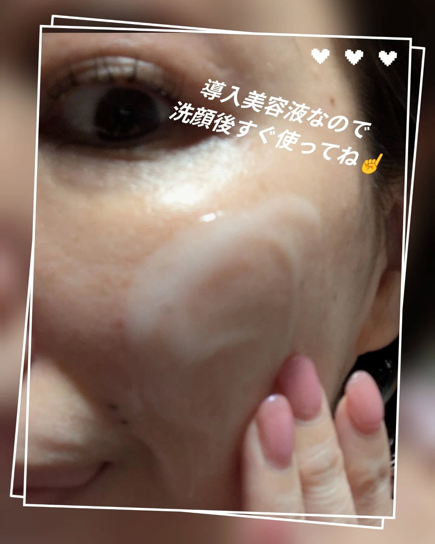 DRワンス　EXニードル　ショットセラム/Dr.Once/美容液を使ったクチコミ（3枚目）