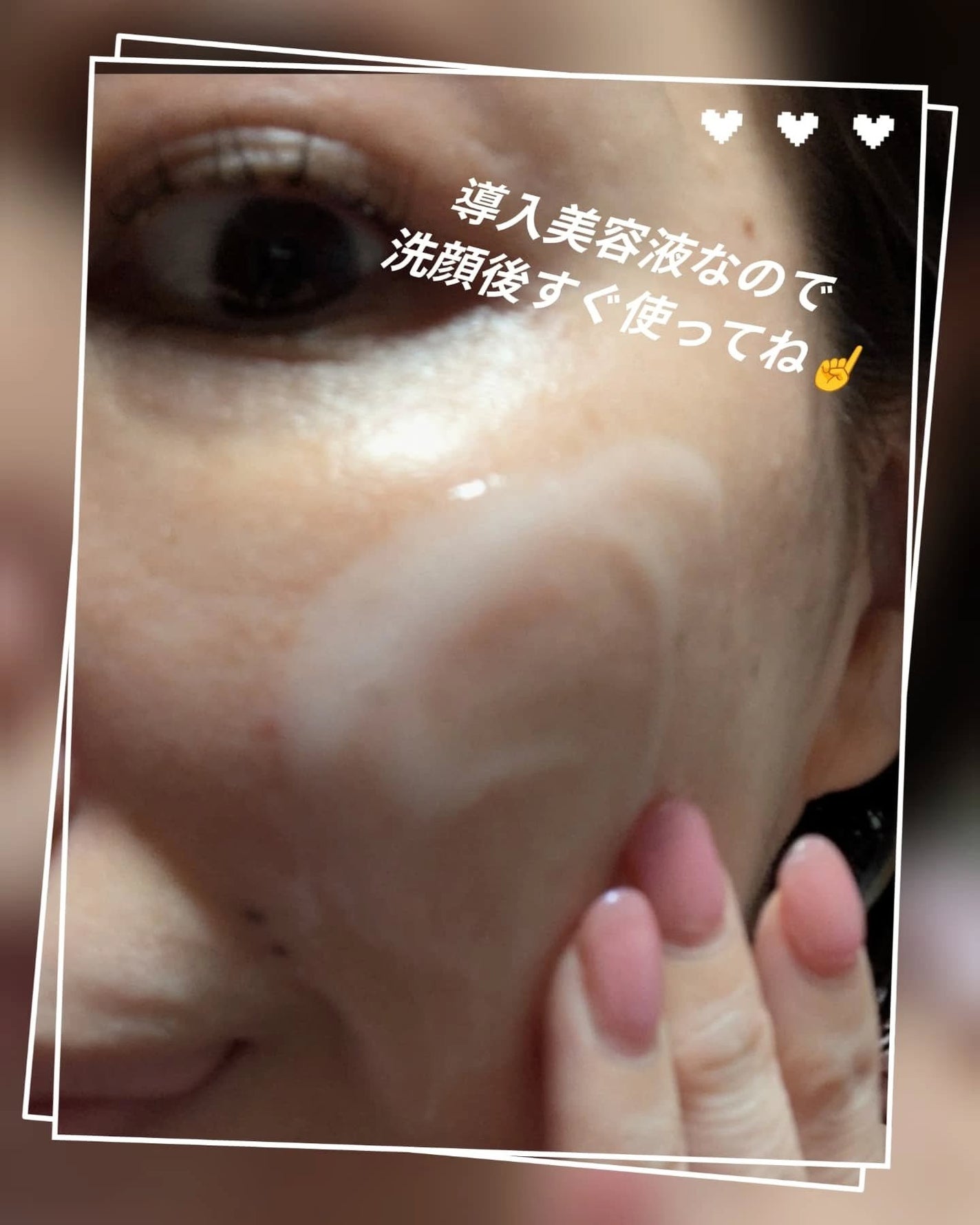 DRワンス EXニードル ショットセラム/Dr.Once/美容液を使ったクチコミ(3枚目)