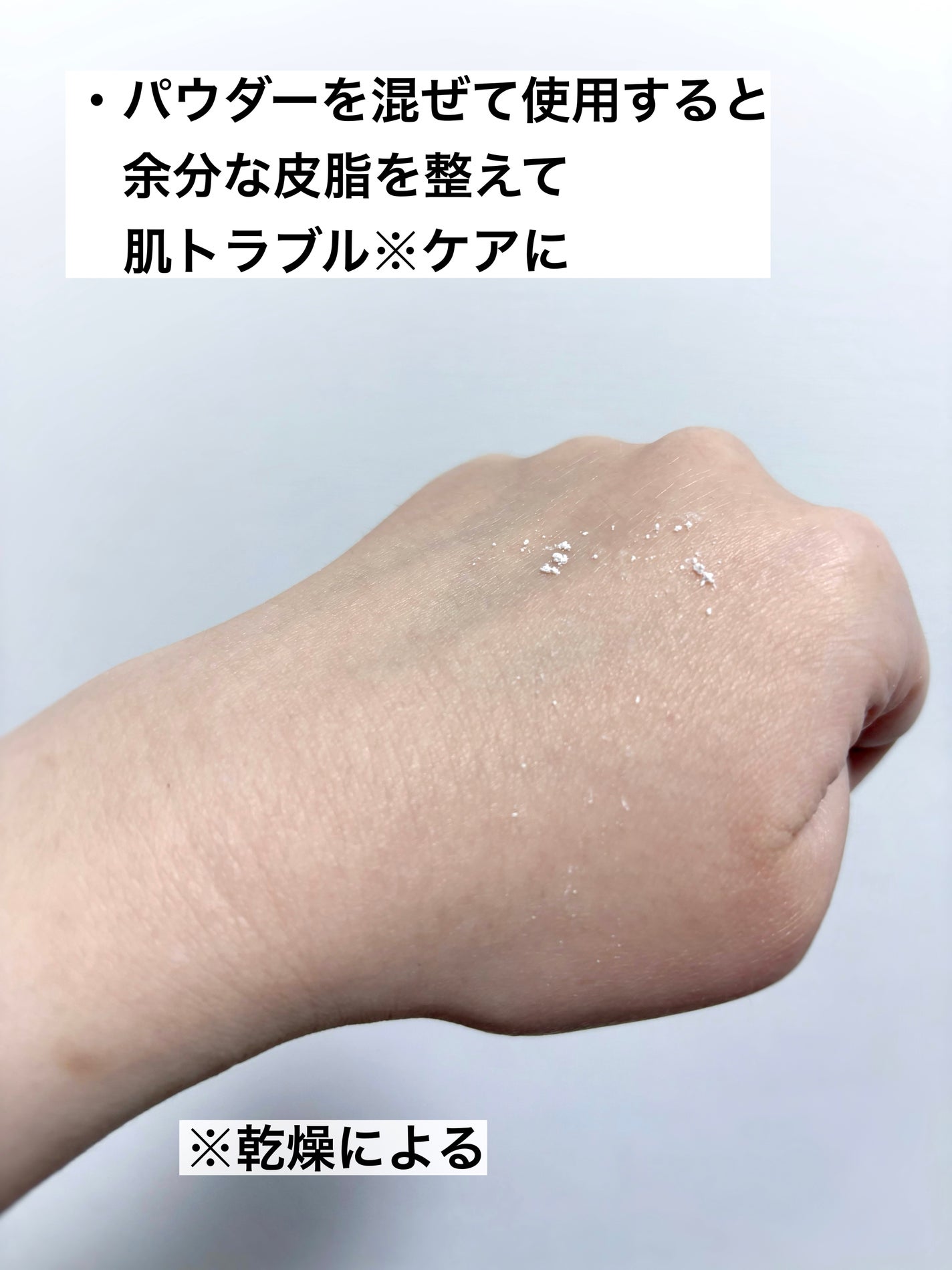 ジンクテカBセラムセット/BRING GREEN/スキンケアキットを使ったクチコミ(5枚目)