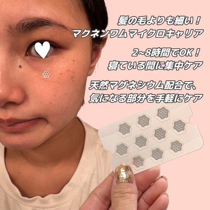 ACマグネシウムパッチ/スノーツープラス/シートマスク・パックを使ったクチコミ(2枚目)