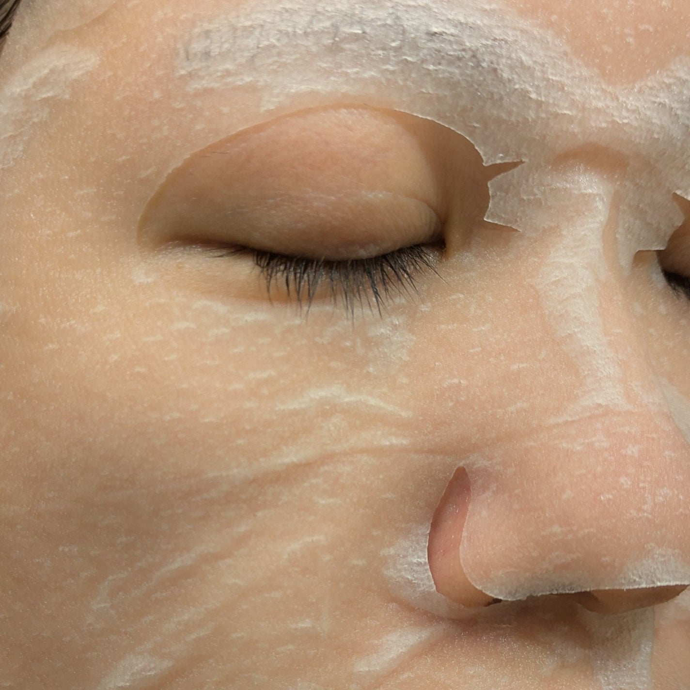 毛穴小町 テカリ源治 マスク/クリアターン/シートマスク・パックを使ったクチコミ(2枚目)