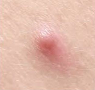 ハトムギ化粧水(ナチュリエ スキンコンディショナー R )/ナチュリエ/化粧水を使ったクチコミ（1枚目）