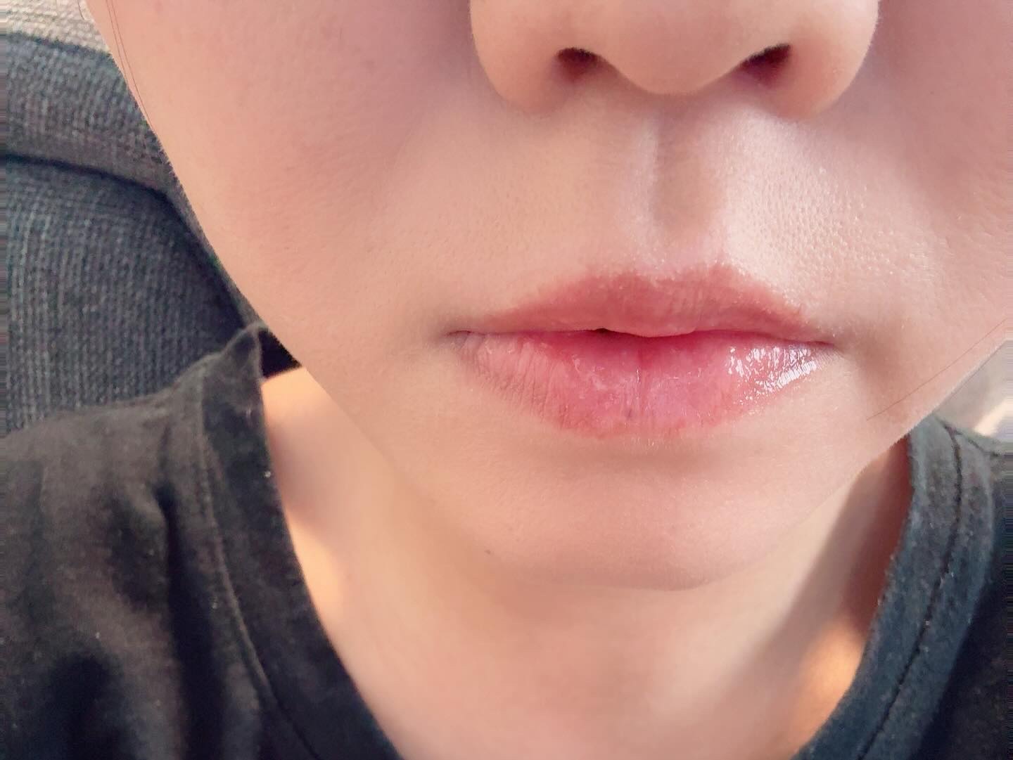 フルーティーグラムティント/Laka/リップティントを使ったクチコミ（2枚目）