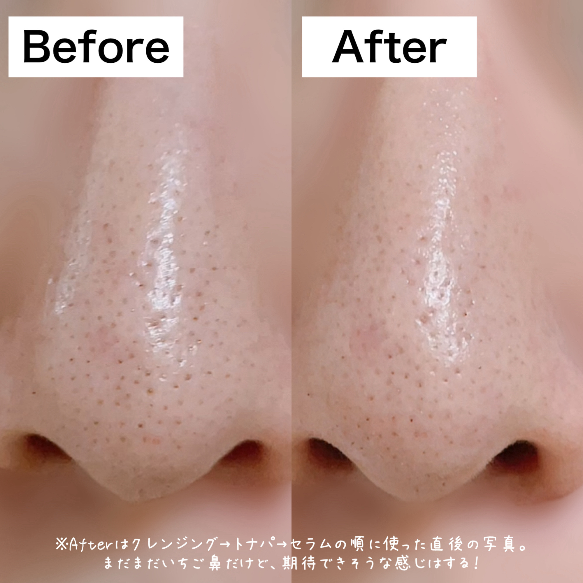 A1カーミング アンプル/VT/美容液を使ったクチコミ（2枚目）