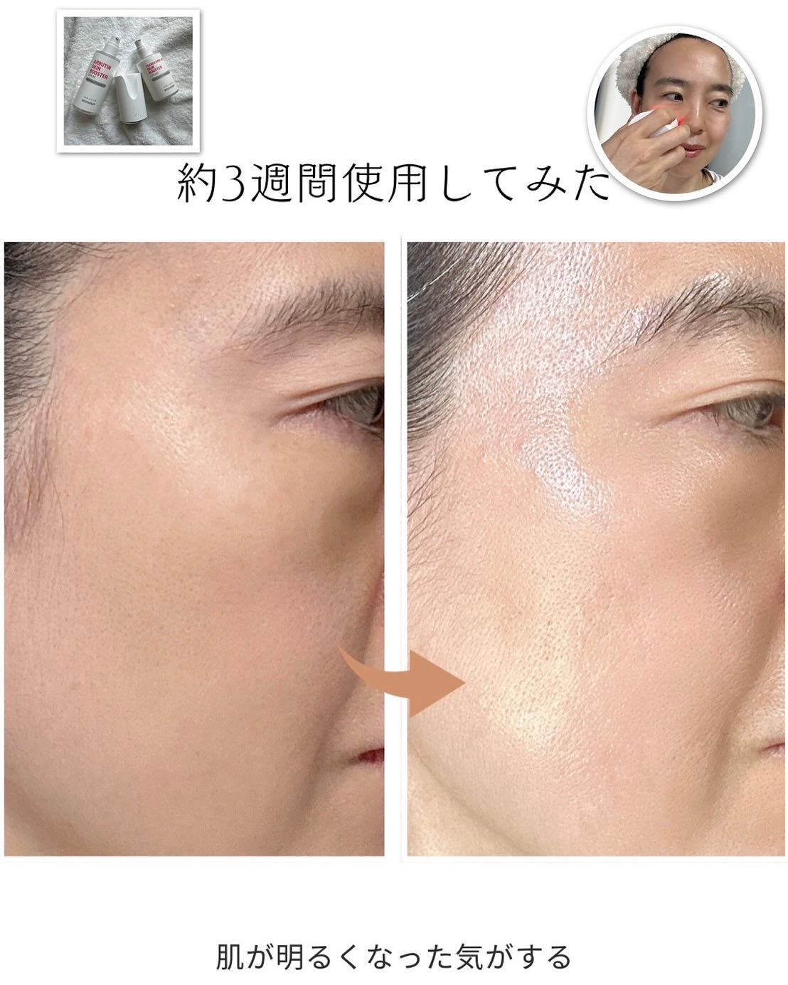 トラネキサム酸スキンブースタークリーム/MEDITHERAPY/フェイスクリームを使ったクチコミ（3枚目）