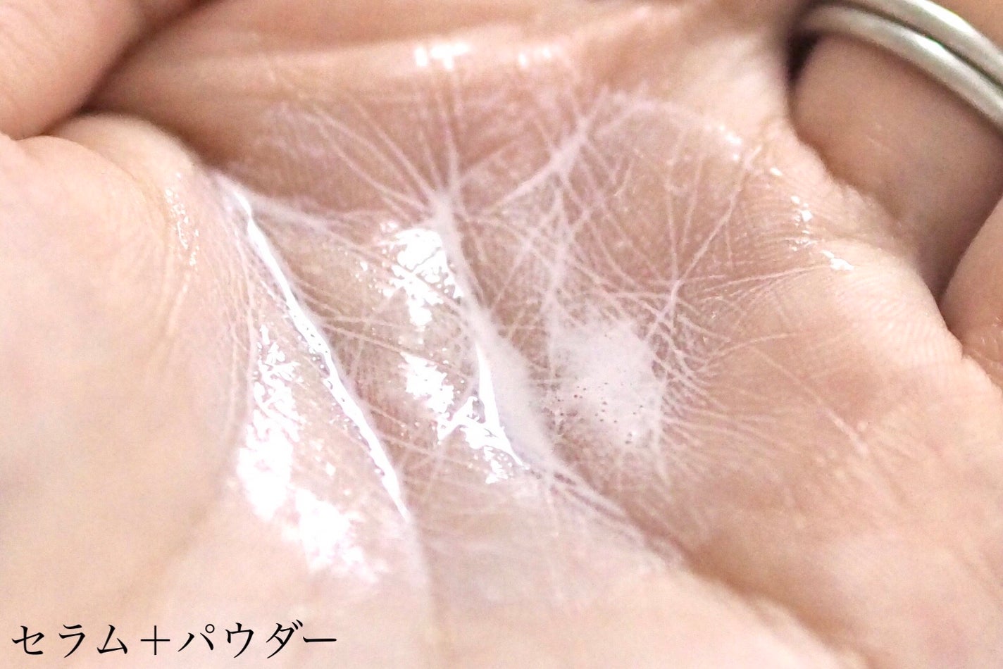 ジンクテカBセラムセット/BRING GREEN/スキンケアキットを使ったクチコミ(4枚目)