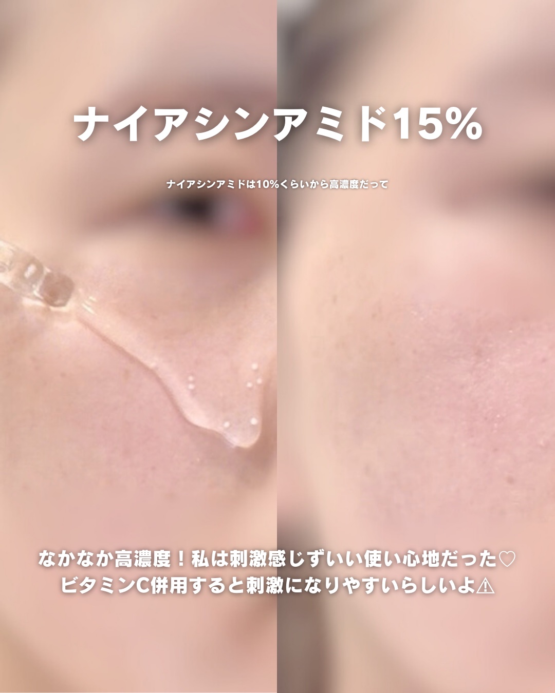 ナイアシンジンクビーズセラム/Frankly/美容液を使ったクチコミ（3枚目）