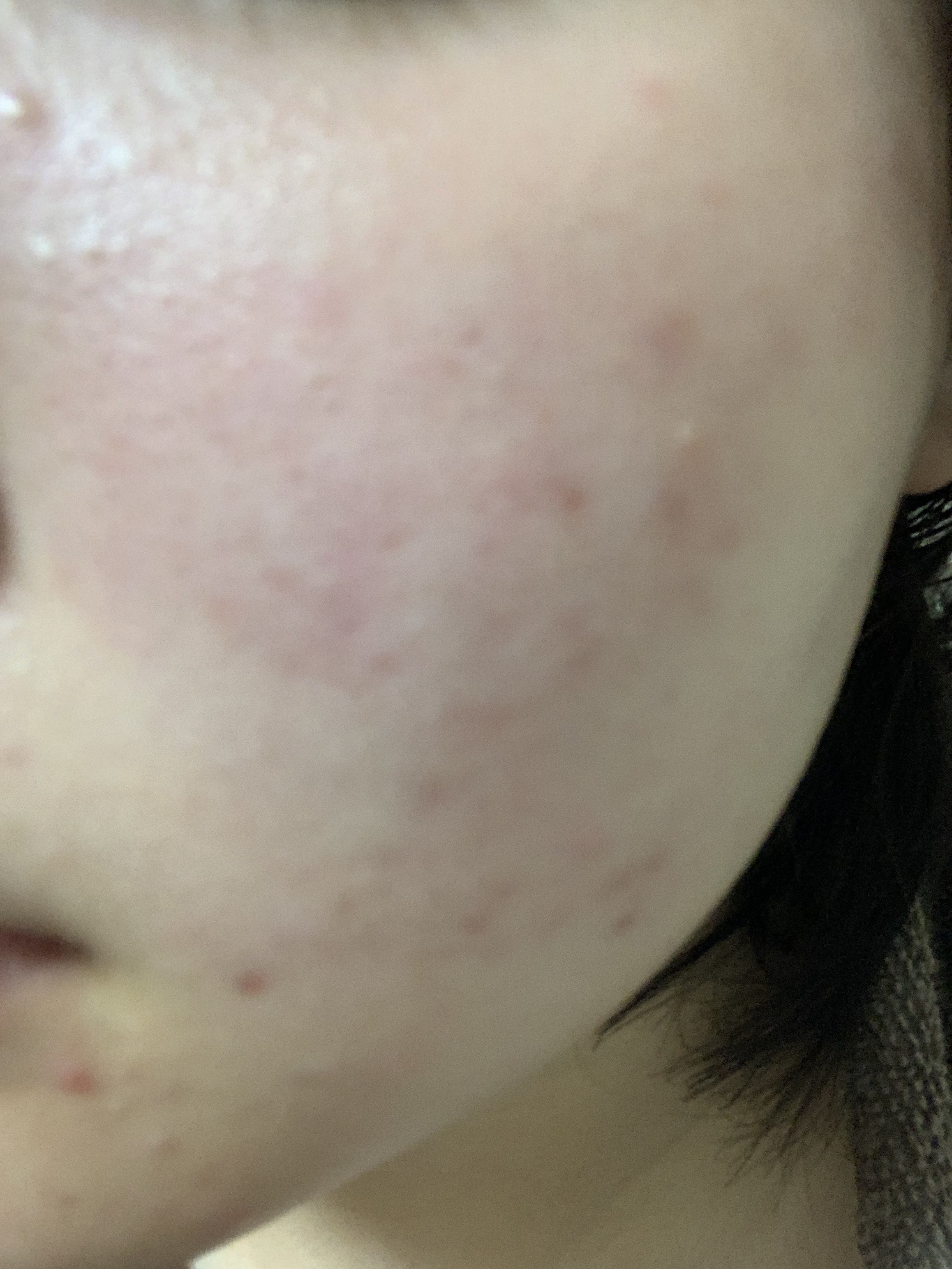 熊野油脂 ピュアビタミンC 化粧水/ウエルシア/化粧水を使ったクチコミ（2枚目）