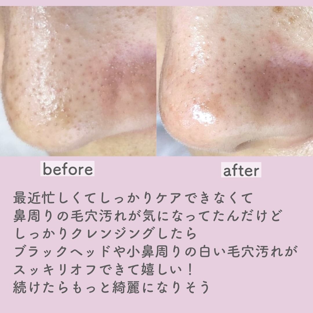 プレミアムもちソープ「グリーンアルティザン」/アレンシア/その他洗顔料を使ったクチコミ(4枚目)