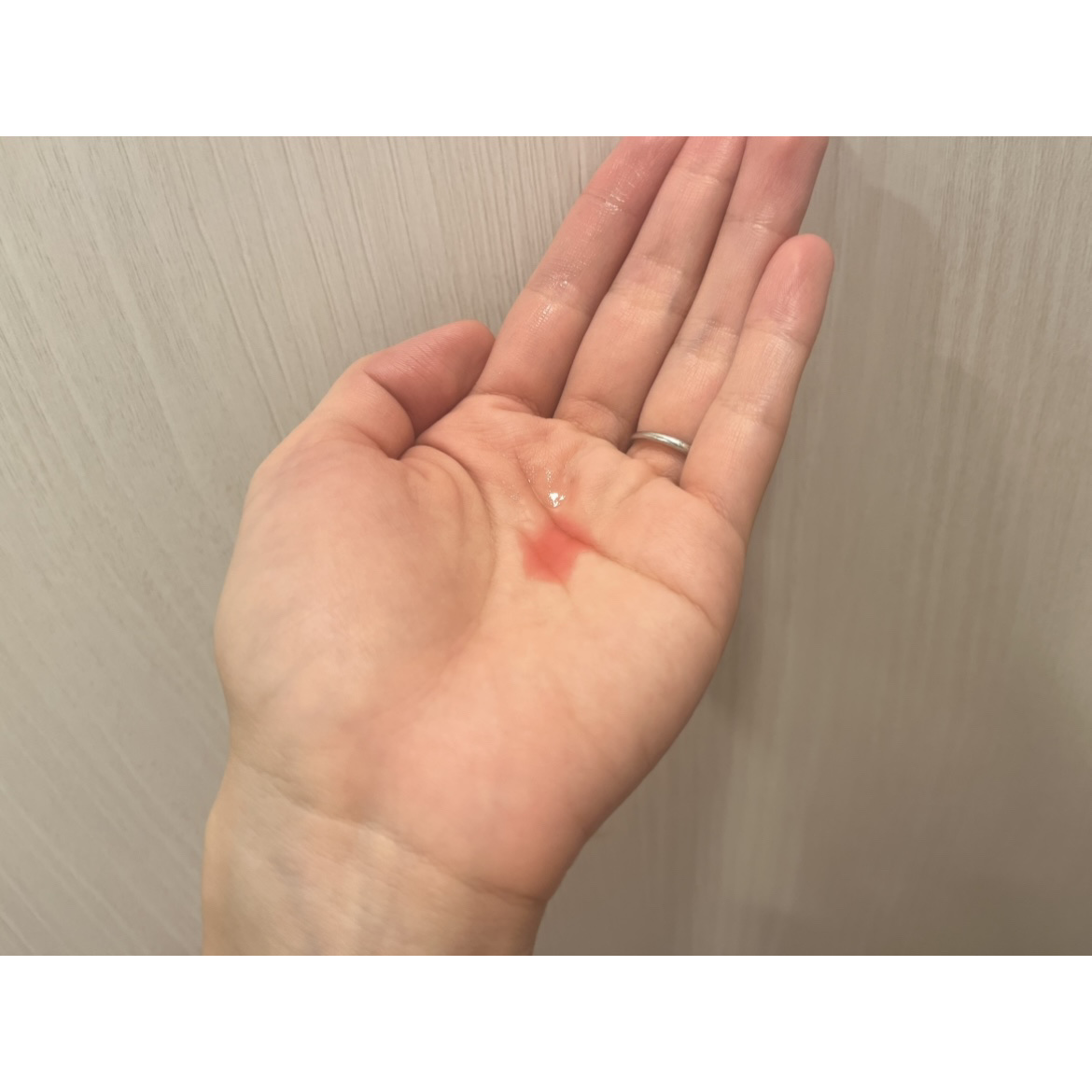 A1カーミング アンプル/VT/美容液を使ったクチコミ（2枚目）