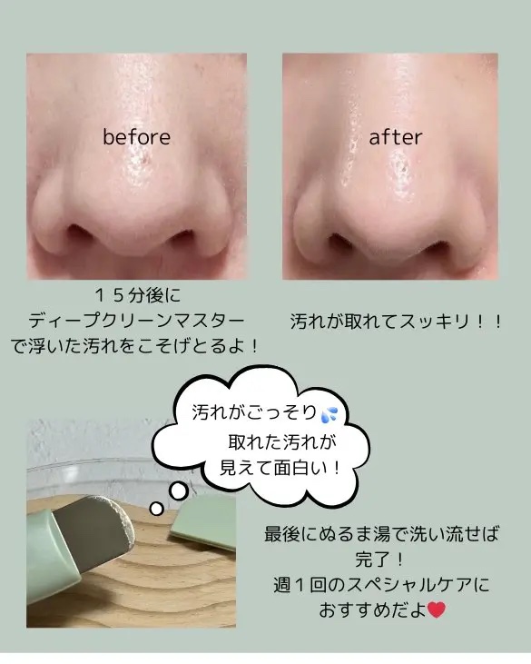 ILSO　スーパーメルティング セバムソフトナー/ilso/化粧水を使ったクチコミ（3枚目）