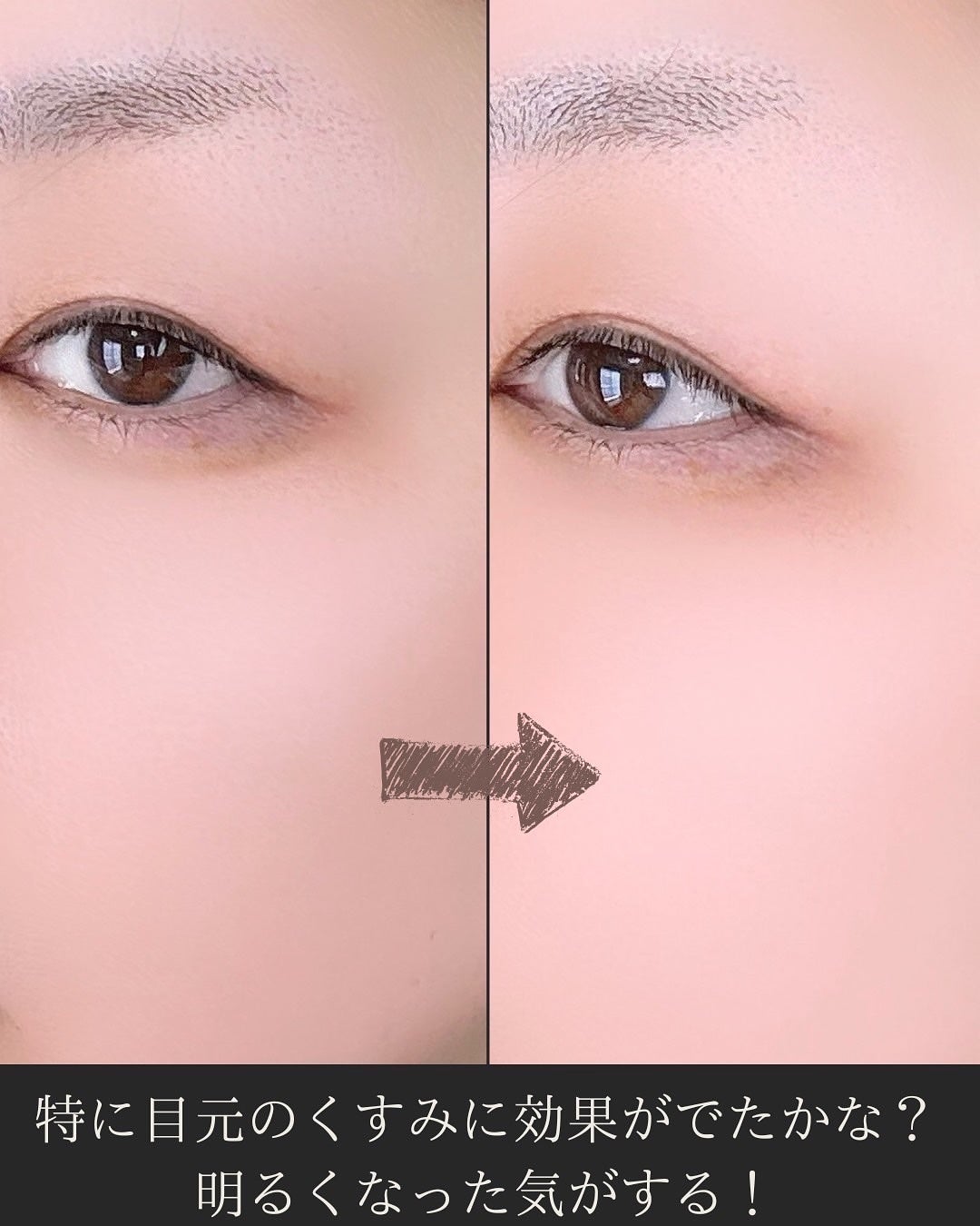 アルブチン スキンブースター セラム/MEDITHERAPY/美容液を使ったクチコミ(3枚目)