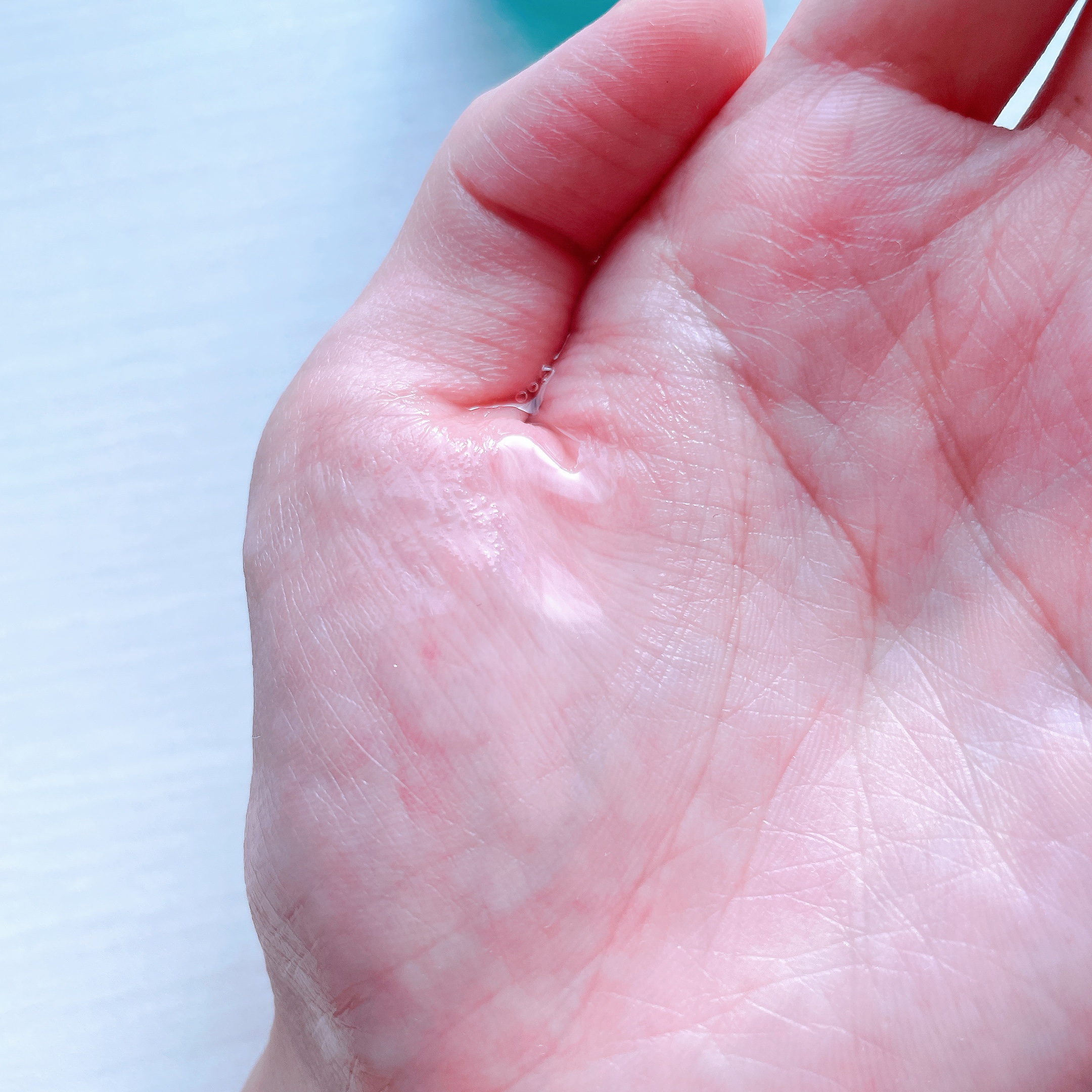 ジンクテカBセラムセット/BRING GREEN/スキンケアキットを使ったクチコミ（3枚目）