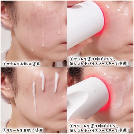 トラネキサム酸スキンブースタークリーム/MEDITHERAPY/フェイスクリームを使ったクチコミ(2枚目)