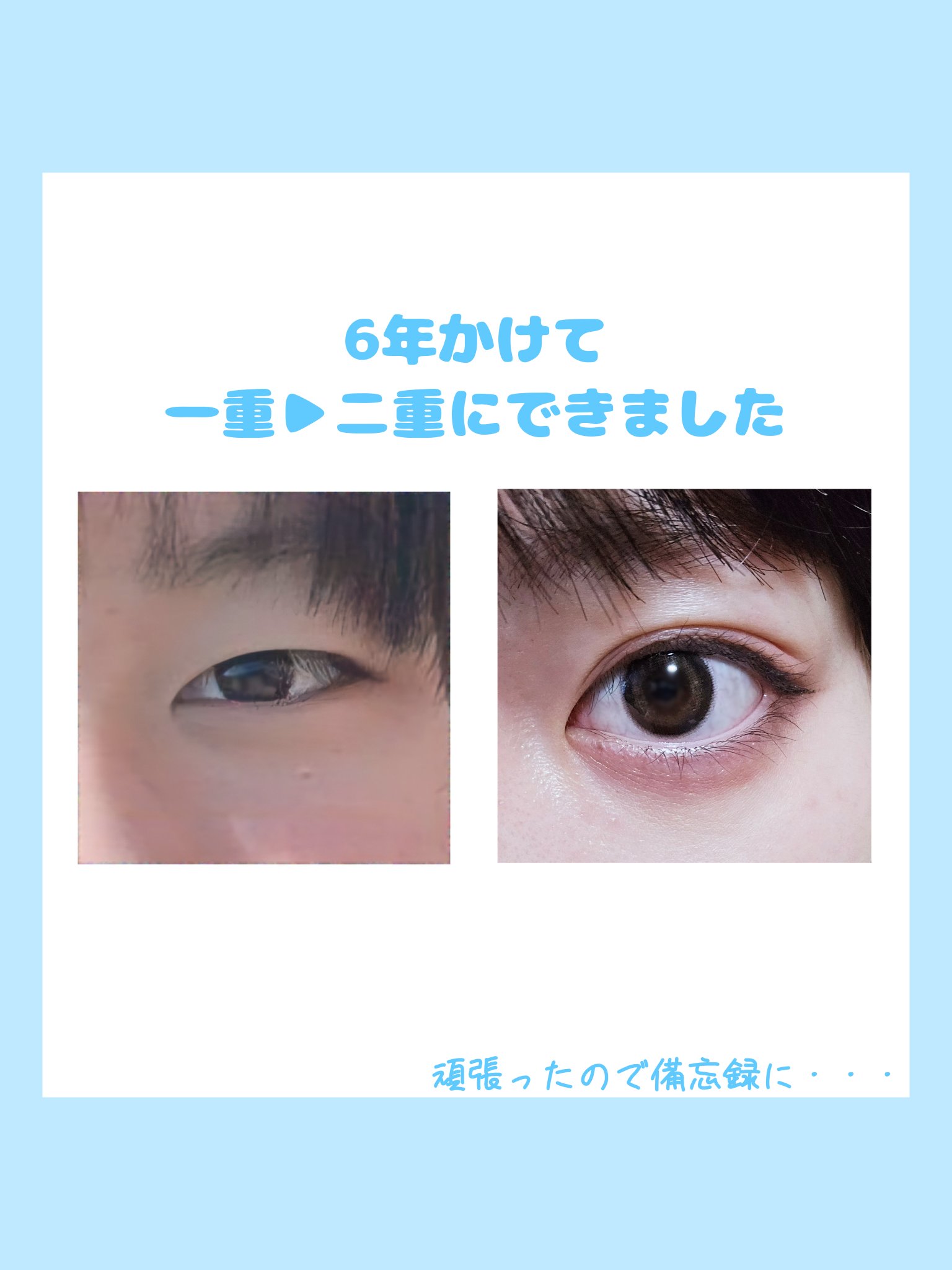 メッシュ アイテープ/shefun/二重まぶた用アイテムを使ったクチコミ（1枚目）