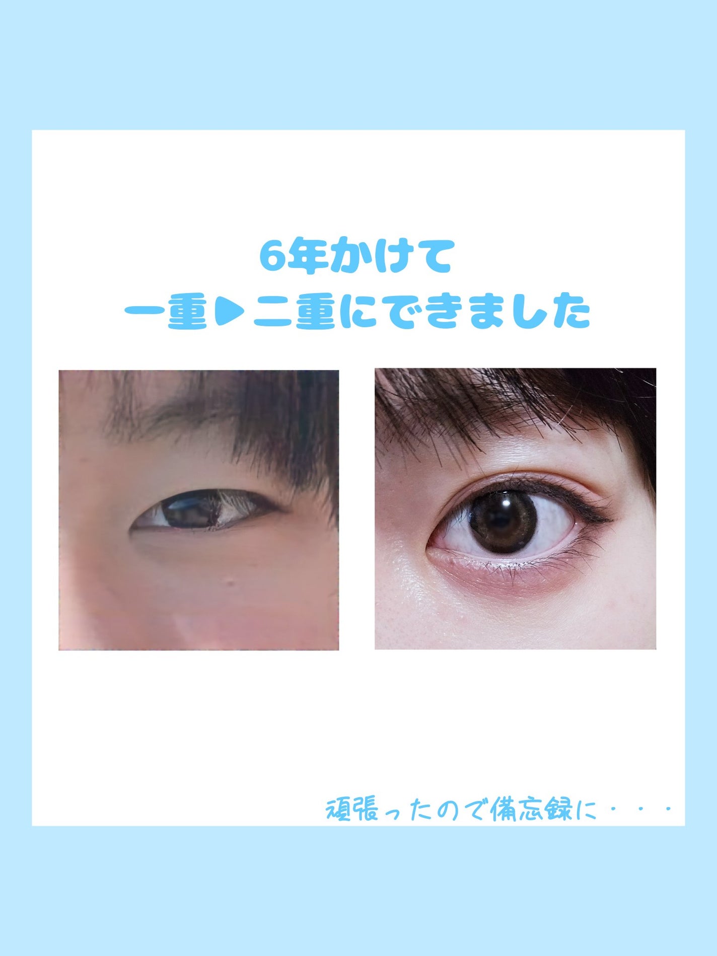 のびーるアイテープ スリムタイプ/DAISO/二重まぶた用アイテムを使ったクチコミ(1枚目)