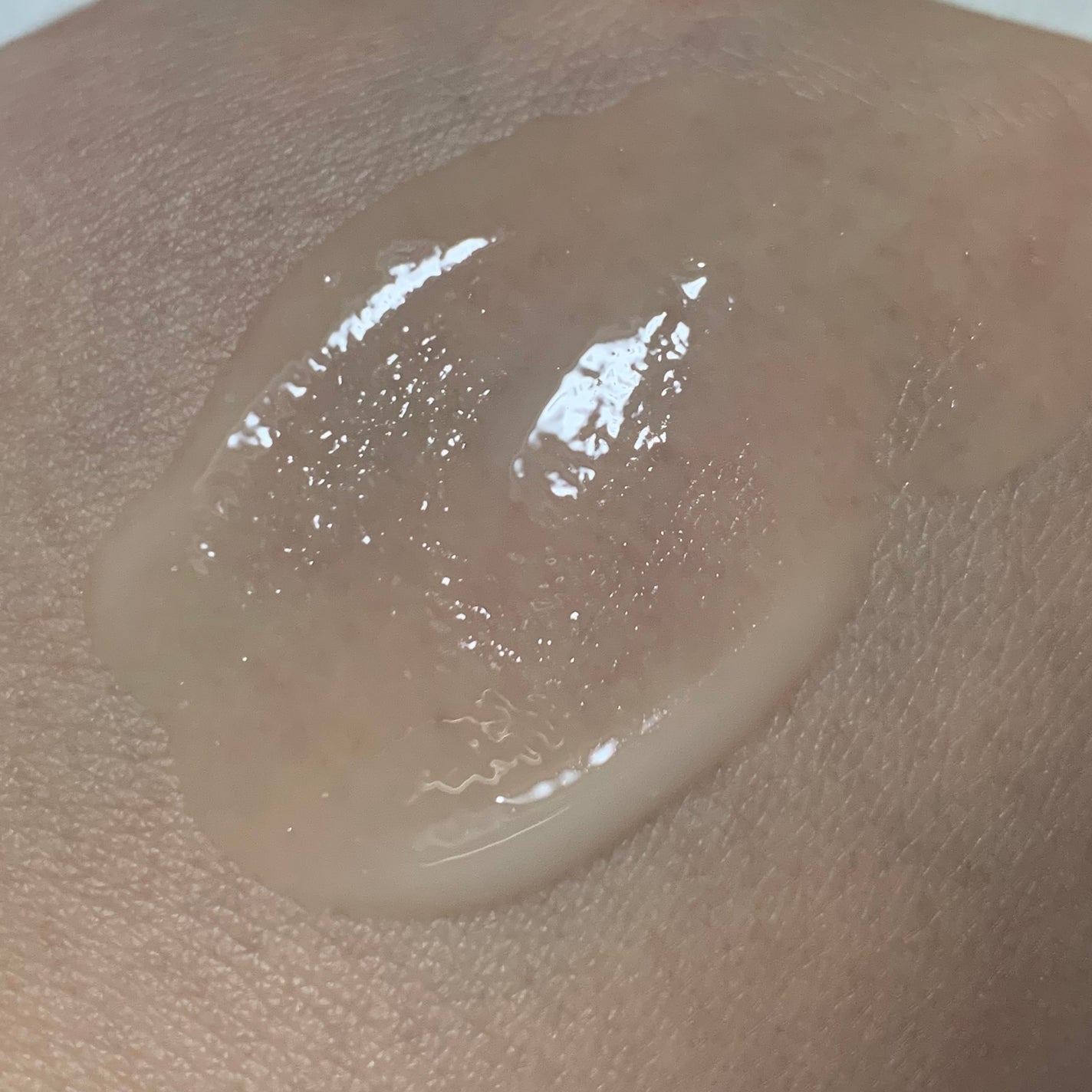 美容原液セラムCA/Bアンプル/美容液を使ったクチコミ(3枚目)