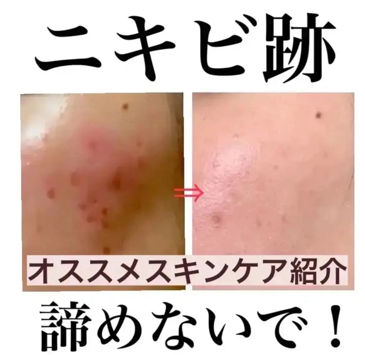 肌が綺麗になったスキンケアアイテム紹介✨

✼••┈┈••✼••┈┈••✼••┈┈••✼••┈┈••✼

♡オルビスクリアフル ローションLさっぱりタイプ

いちばんのオススメ！

値段もプチプラで手を出しやすいし、ノンコメ