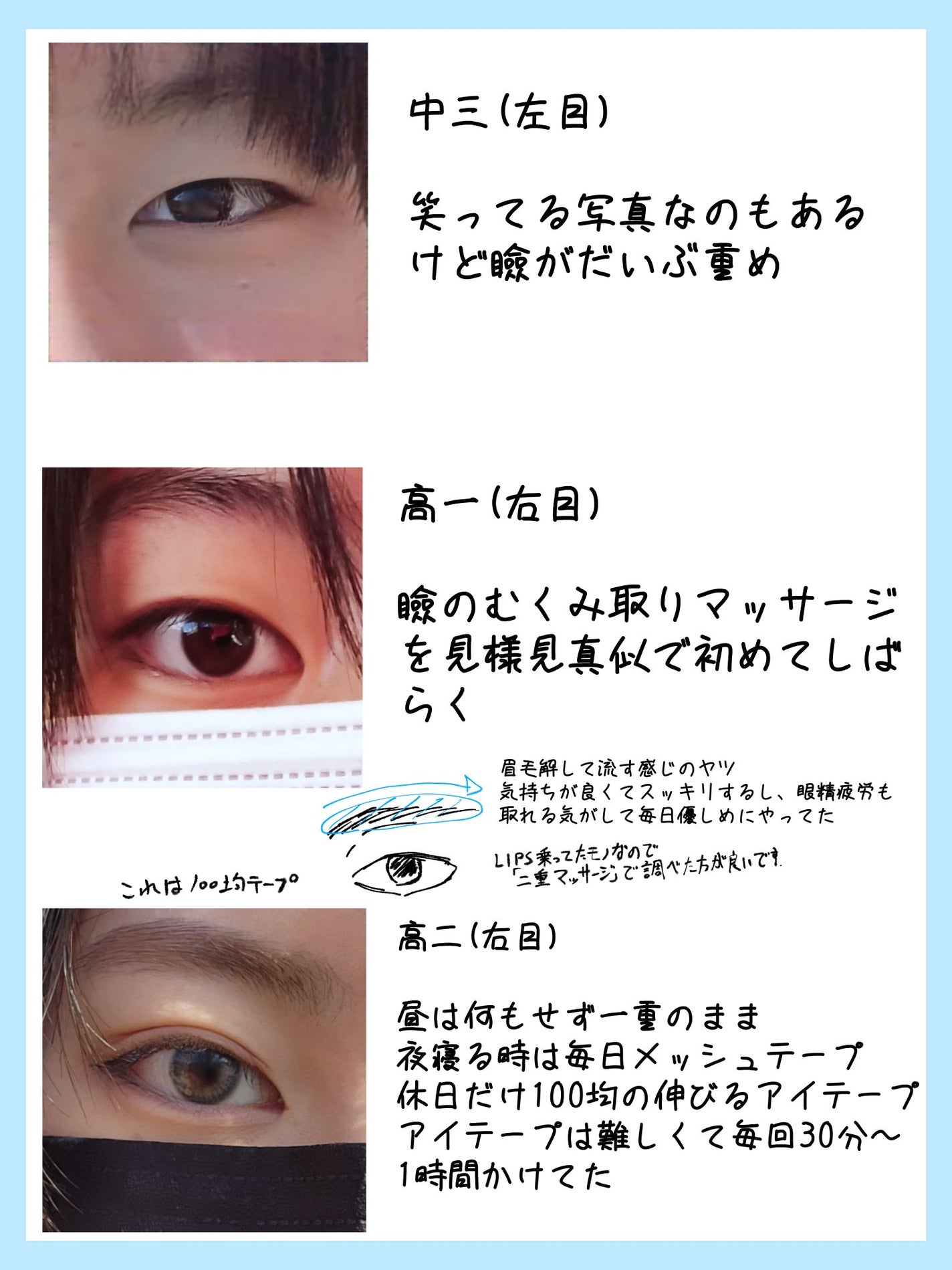 のびーるアイテープ スリムタイプ/DAISO/二重まぶた用アイテムを使ったクチコミ(2枚目)