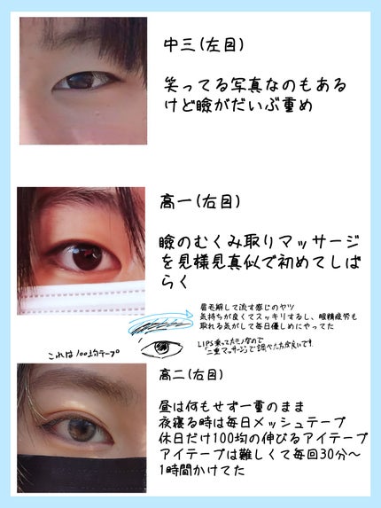 のびーるアイテープ スリムタイプ/DAISO/二重まぶた用アイテムを使ったクチコミ(2枚目)